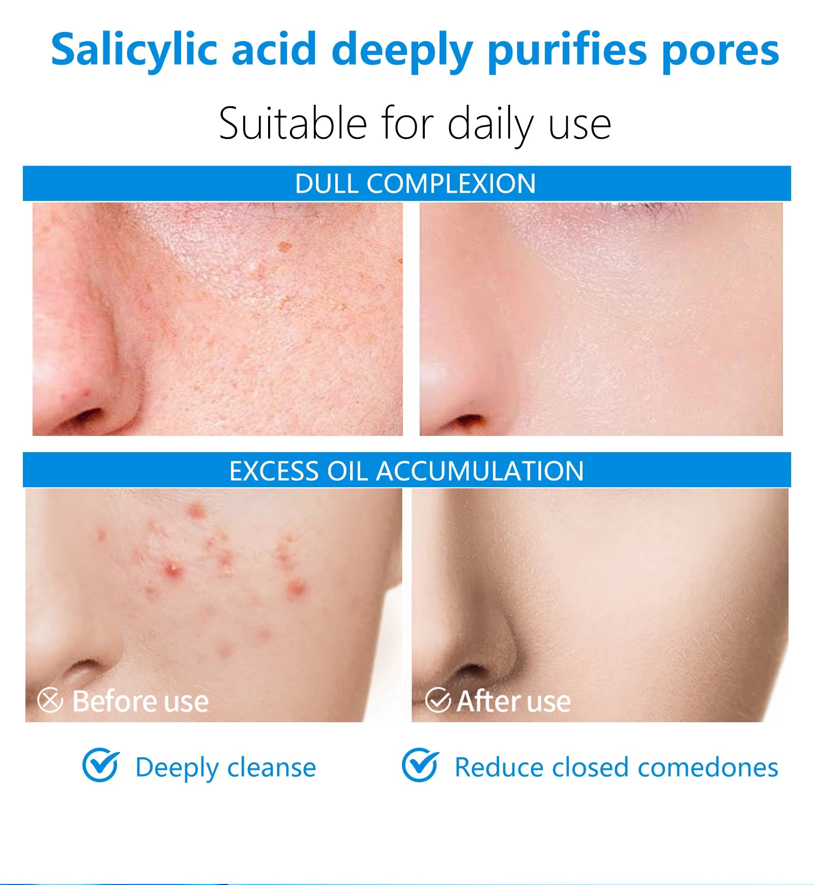 These dual-effect facial toner pads contain 4.5% AHA lactic acid and 0.45% BHA salicylic acid for exfoliation skincare