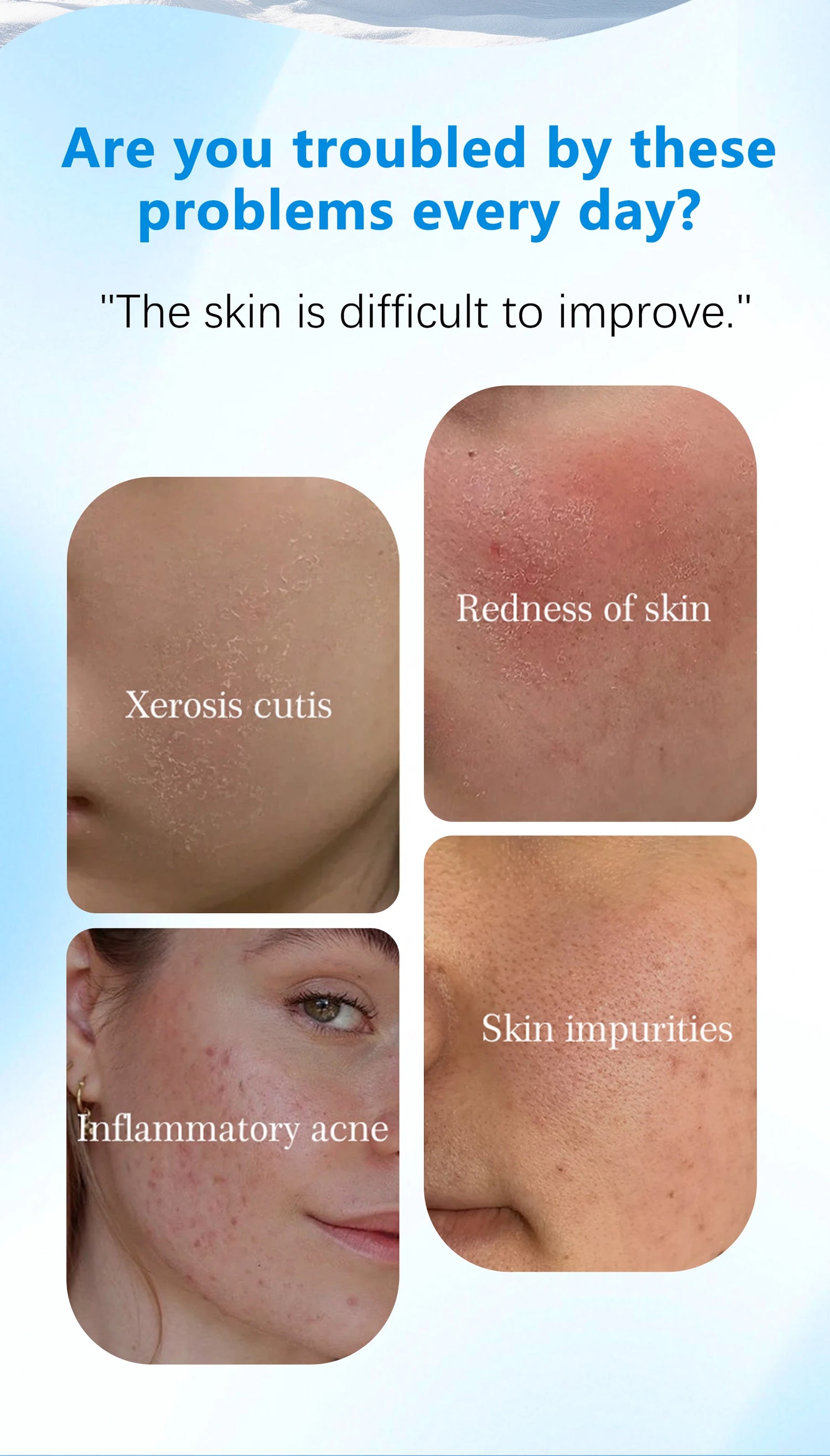 These dual-effect facial toner pads contain 4.5% AHA lactic acid and 0.45% BHA salicylic acid for exfoliation skincare