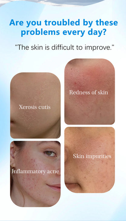 These dual-effect facial toner pads contain 4.5% AHA lactic acid and 0.45% BHA salicylic acid for exfoliation skincare