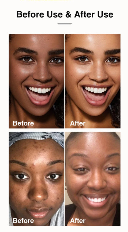 AILKE Organic Turmeric Toner for Face, Removal Acne, Pimples, Spots, Moisturizing, Brightening, Smooths Skin, Parabens Free