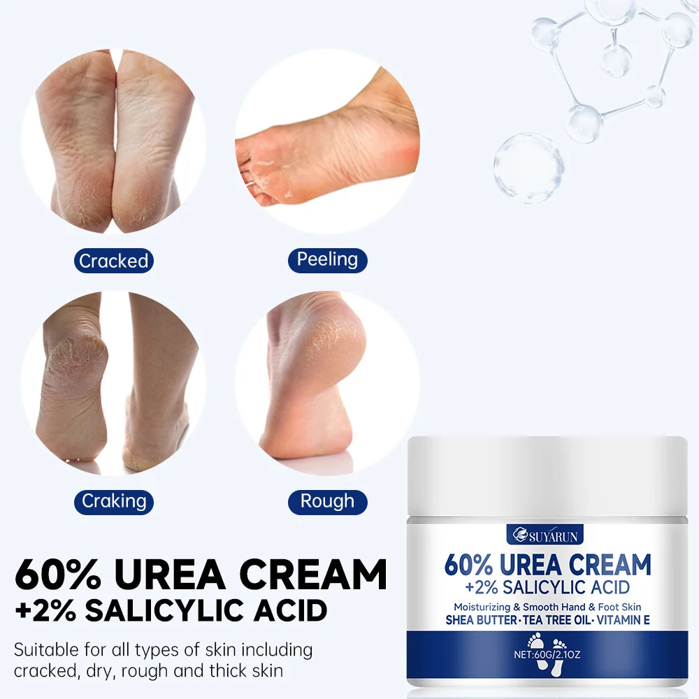 SUYARUN 60 Urea Foot Cream for Cracked Heels &amp; Dry Feet