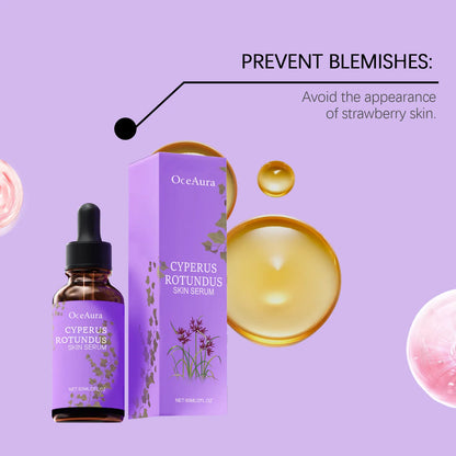 Depilatory Essence: Gentle Care, Refreshing, No Black Spots Left, Daily Skin Cleansing and Depilatory Care Essence Liquid