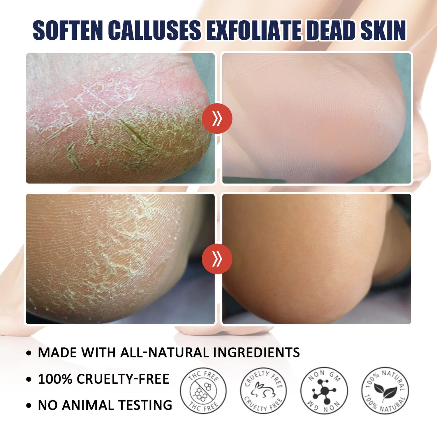 Hand Foot Cream Hydrating Moisturizing to Improve Dry Skin Nourishing Care with Shea Butter Beeswax Lightweight and Non Greasy