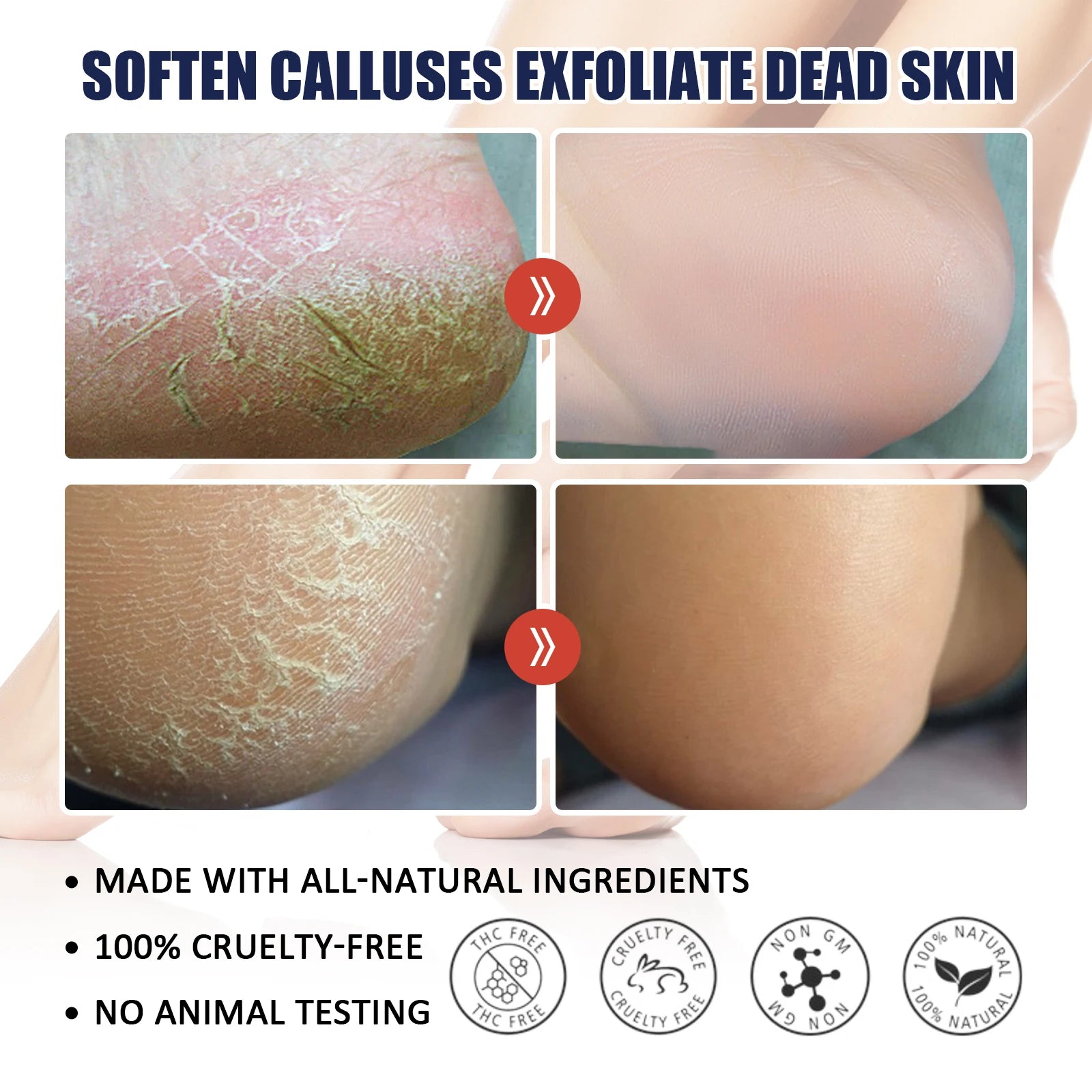 Hand Foot Cream Hydrating Moisturizing to Improve Dry Skin Nourishing Care with Shea Butter Beeswax Lightweight and Non Greasy