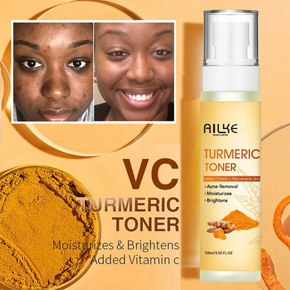 AILKE Organic Turmeric Toner for Face, Removal Acne, Pimples, Spots, Moisturizing, Brightening, Smooths Skin, Parabens Free