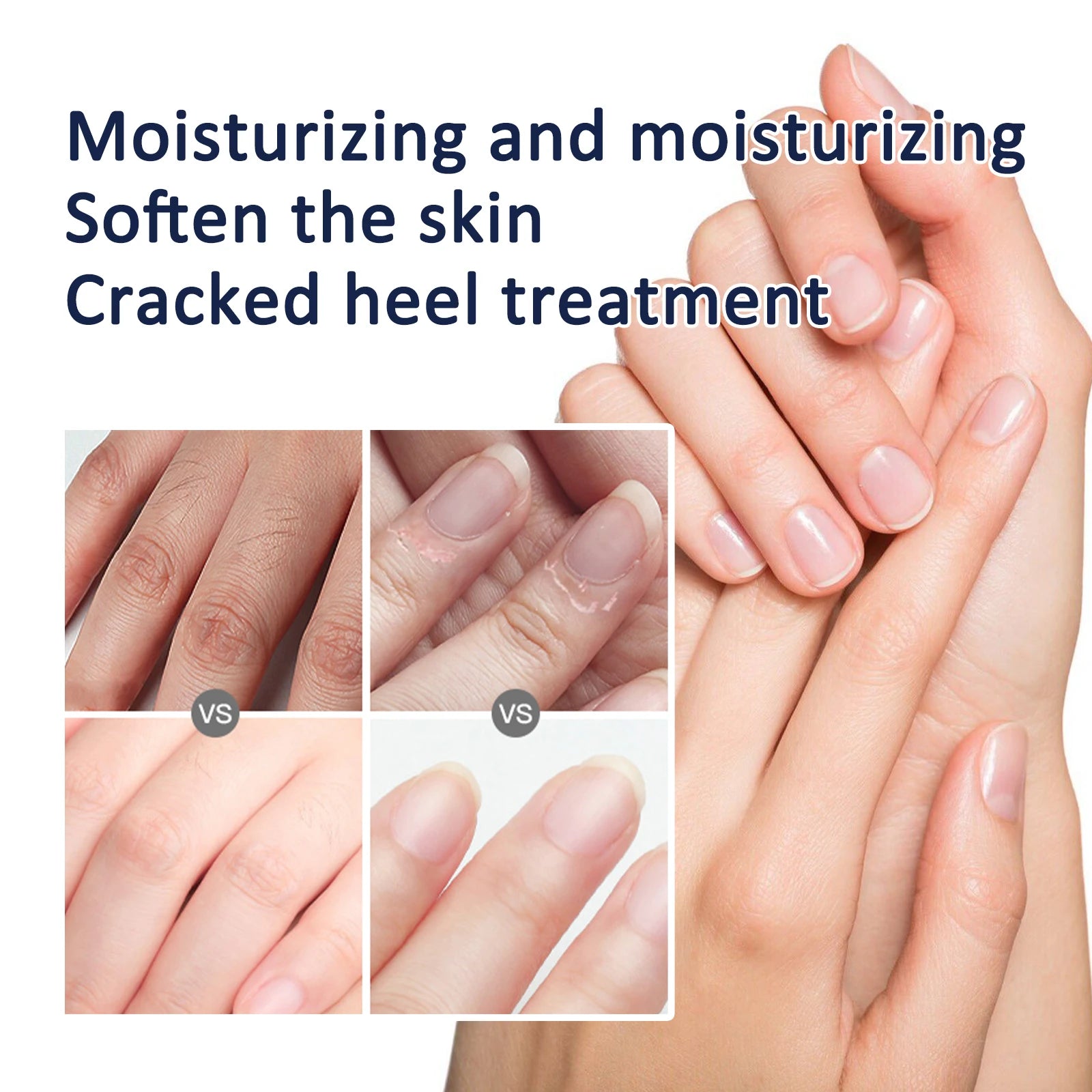 Hand Foot Cream Hydrating Moisturizing to Improve Dry Skin Nourishing Care with Shea Butter Beeswax Lightweight and Non Greasy