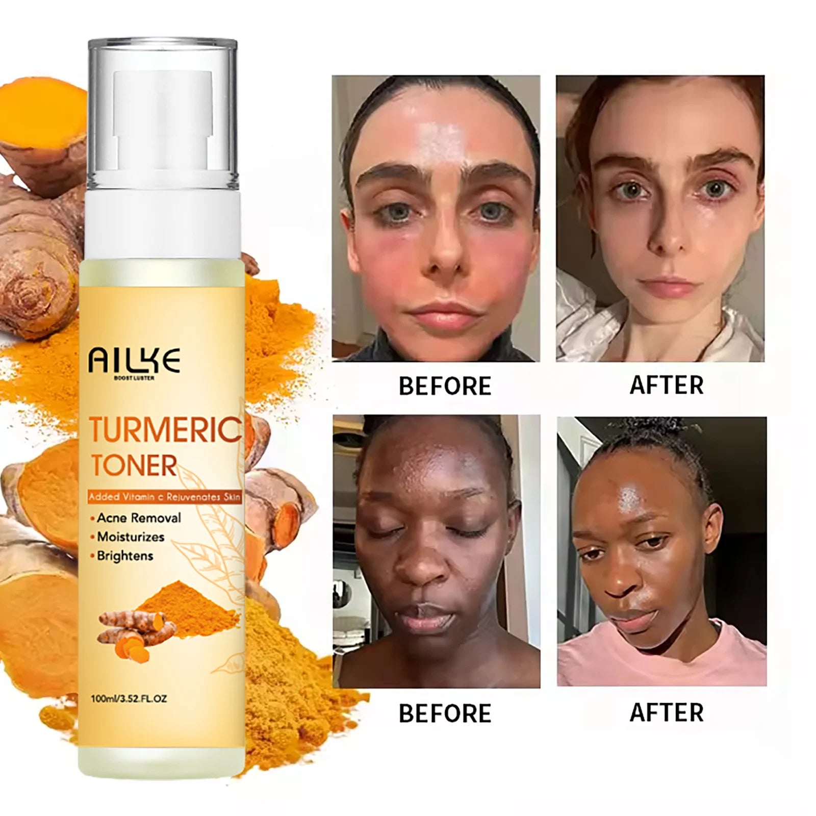 AILKE Organic Turmeric Toner for Face, Removal Acne, Pimples, Spots, Moisturizing, Brightening, Smooths Skin, Parabens Free