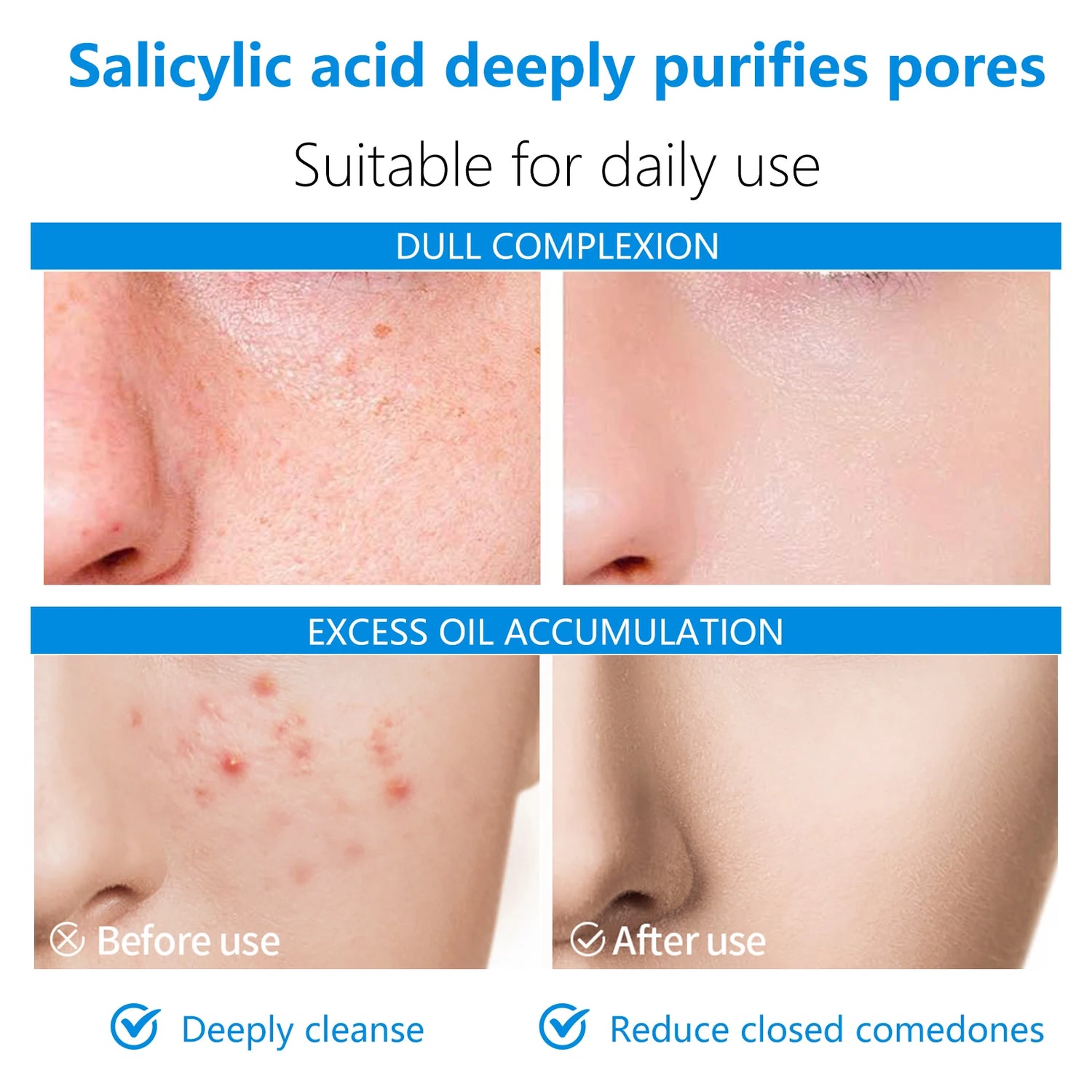 These dual-effect facial toner pads contain 4.5% AHA lactic acid and 0.45% BHA salicylic acid for exfoliation skincare
